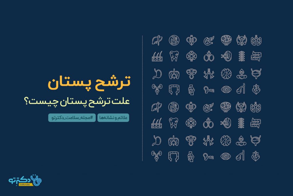 ترشح پستان