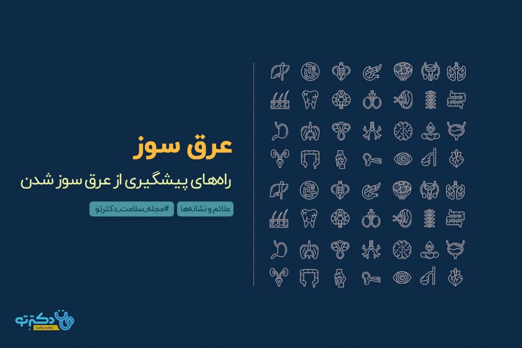 دلایل عرق سوز شدن