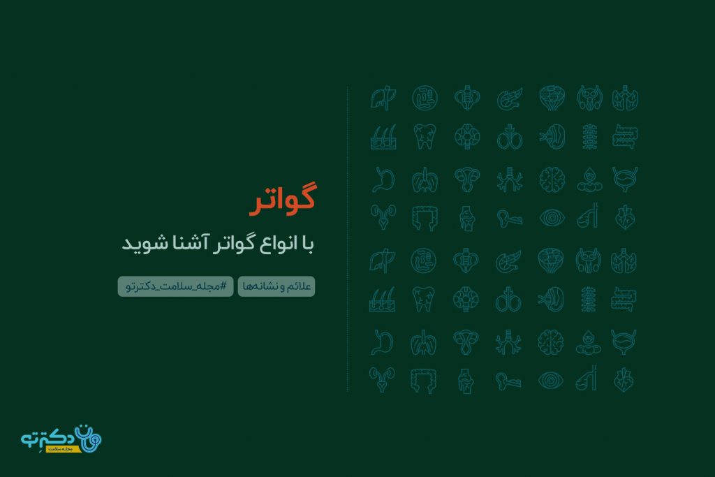 گواتر