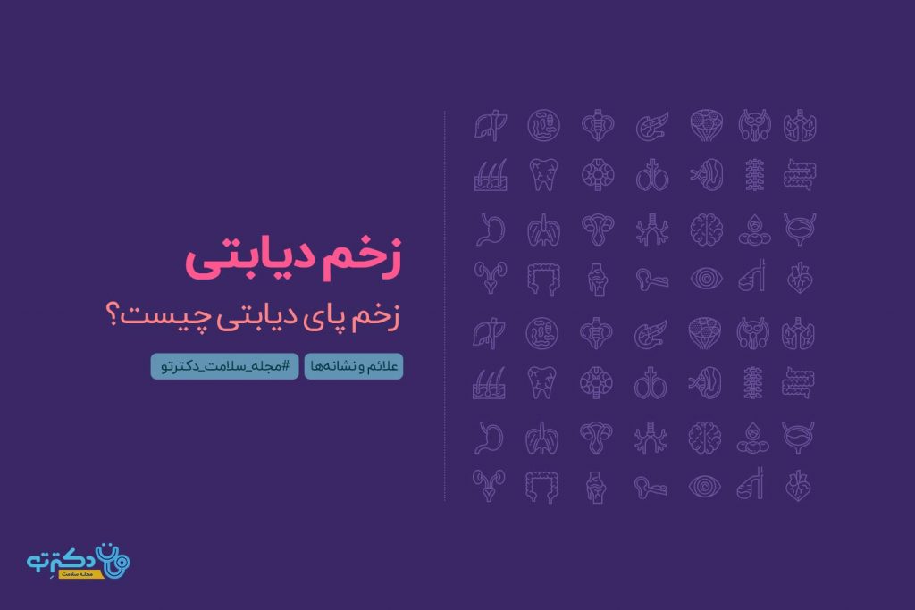 زخم پای دیابتی