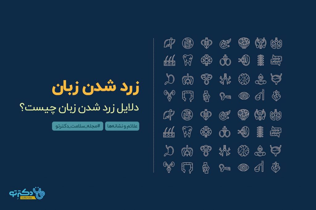 زرد شدن زبان