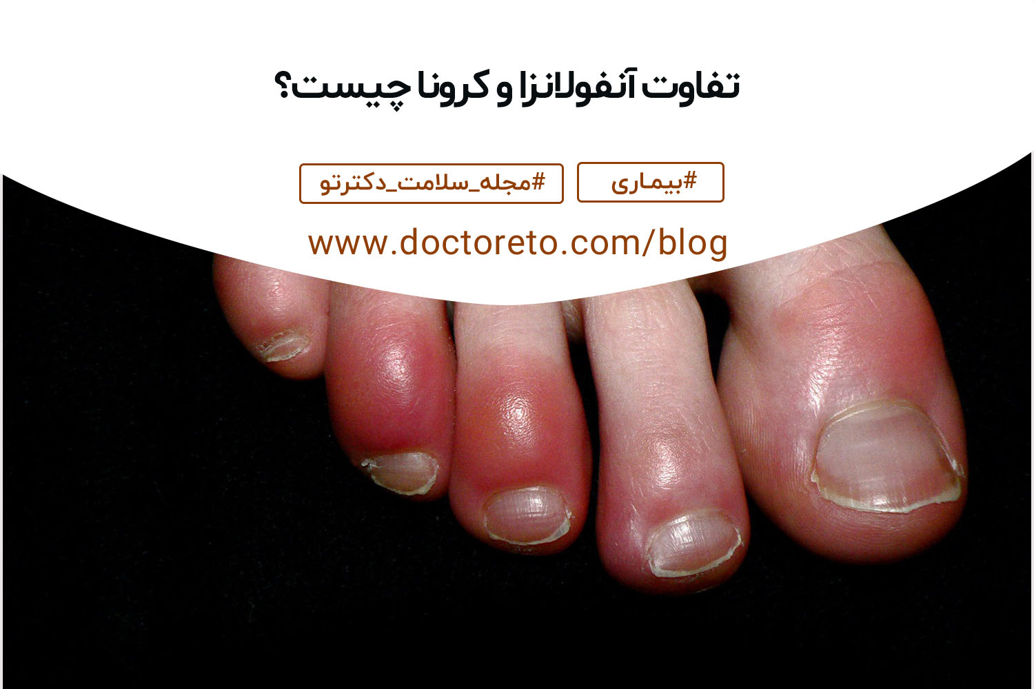 تفاوت آنفولانزا و کرونا