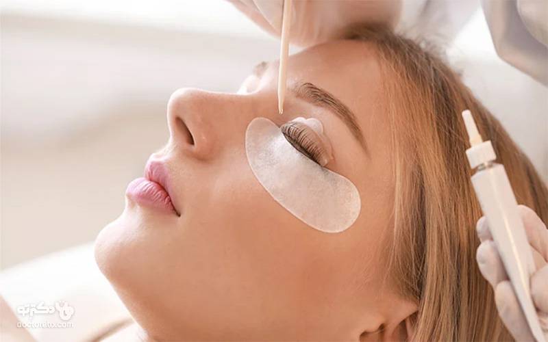 لیفت مژه چیست؟