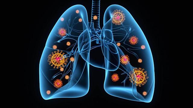 lungs-in-covid