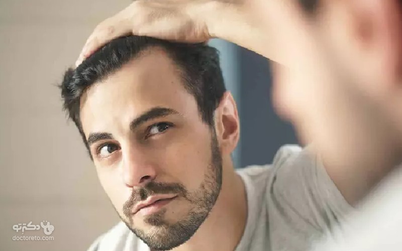 پروتز مو چیست؟