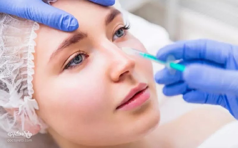 فیلر بینی چیست؟