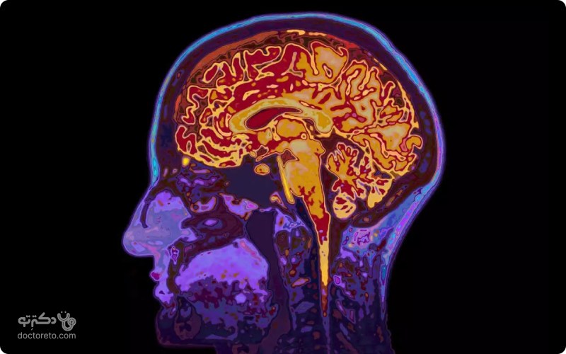 ام ار ای (MRI) چیست و چه کاربردی دارد؟