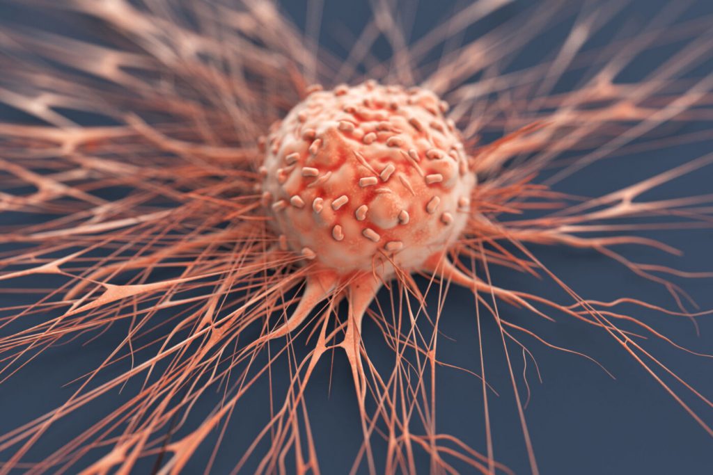 metastasis