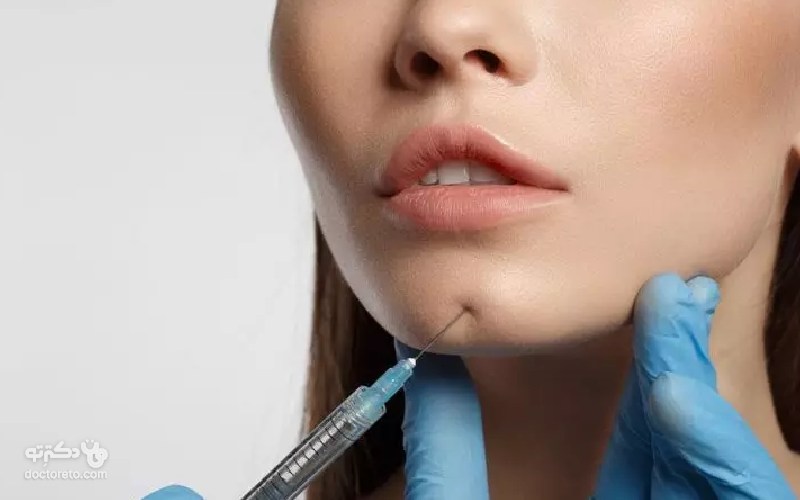 تزریق ژل چانه چیست؟