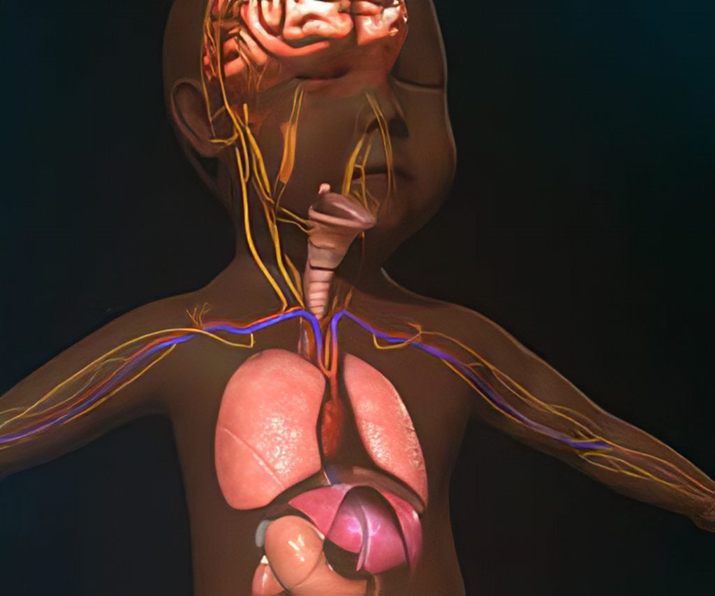 niemann-pick-disease