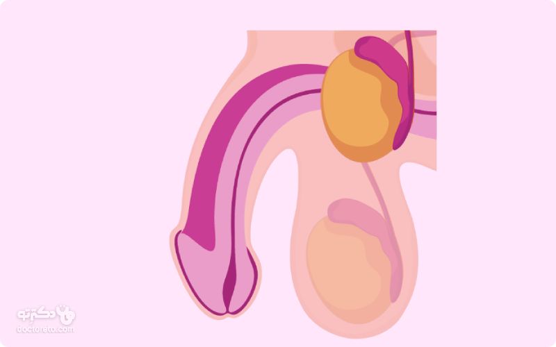 سرطان بیضه چیست؟