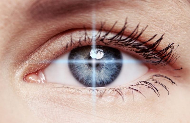 astigmatism