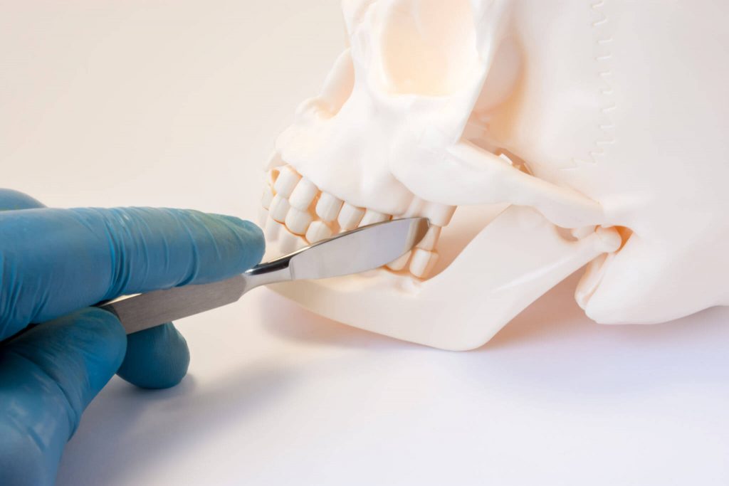 Orthognathic Surgery