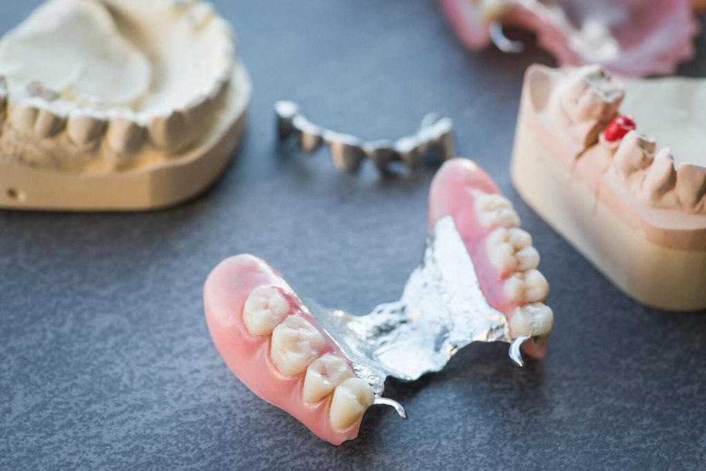 dental prostheses