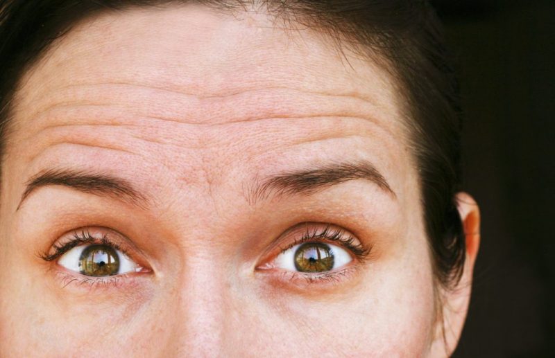wrinkles on the forehead