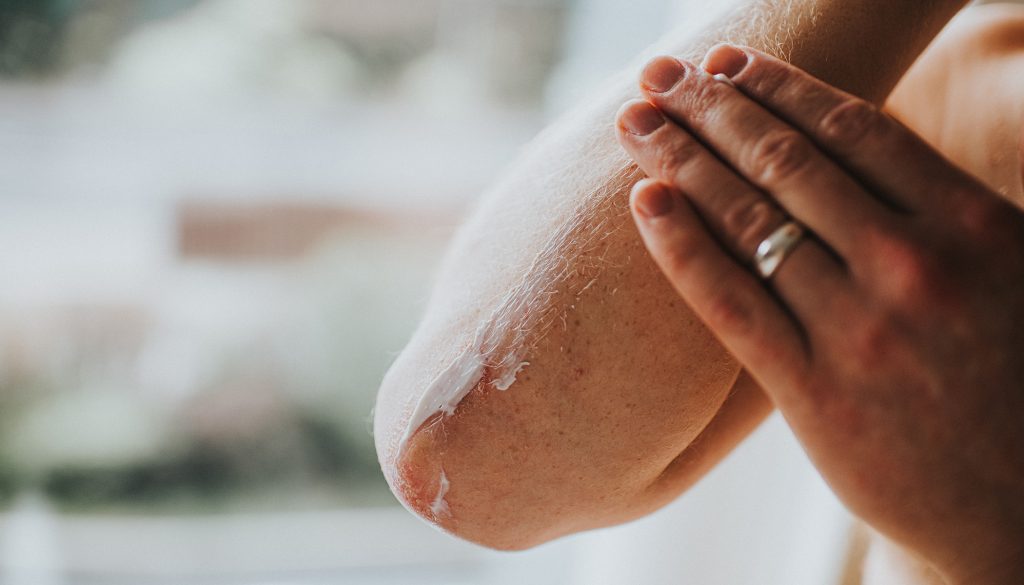 skin dryness
