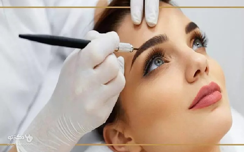 کاشت ابرو چیست؟