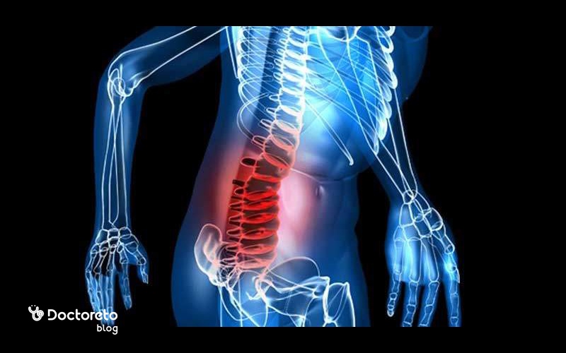 انحراف ستون فقرات چیست و چگونه درمان می شود؟