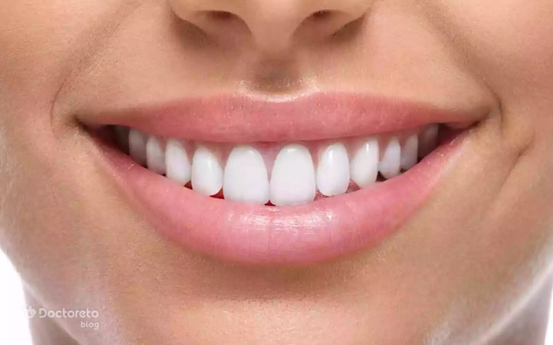 تفاوت لمینت و کامپوزیت چیست؟ ۷ فرق این دو روش زیبایی دندان