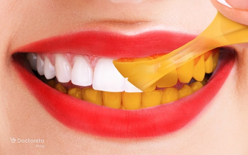 علت زرد شدن دندان ها چیست؟