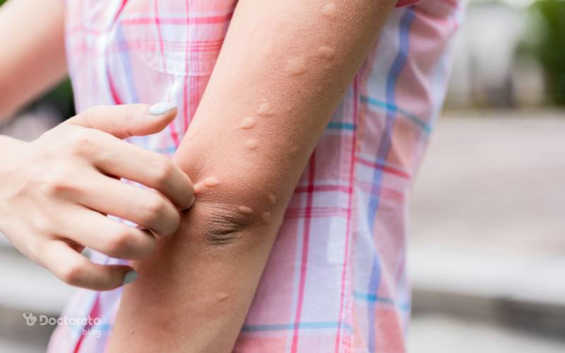 چرا قارچ پوستی خوب نمیشه؟