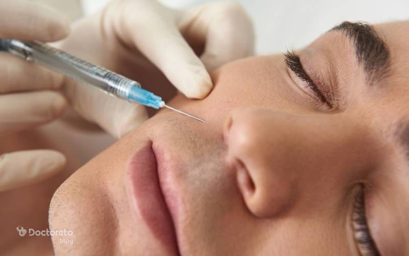 عکس تزریق ژل خط خنده بدین شرح است.